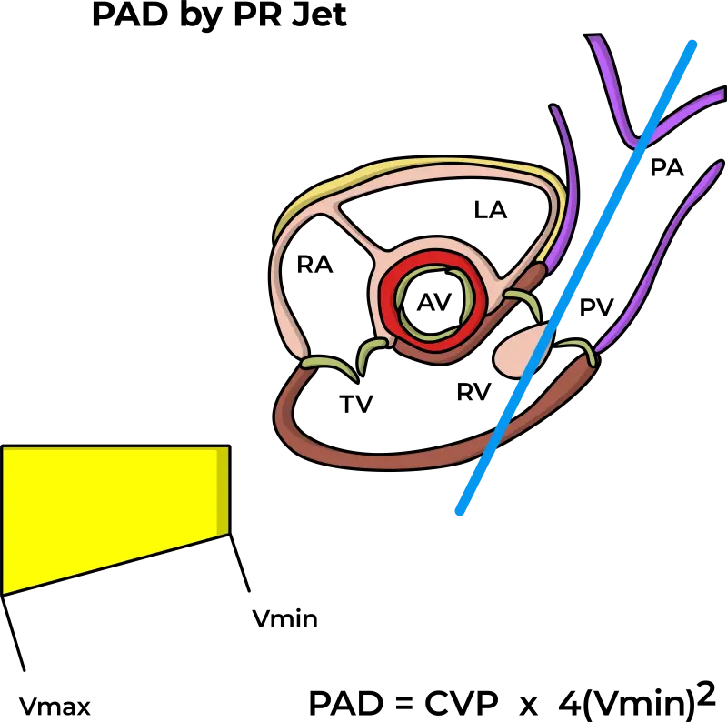 Pulmonary Artery Diastolic Pressure